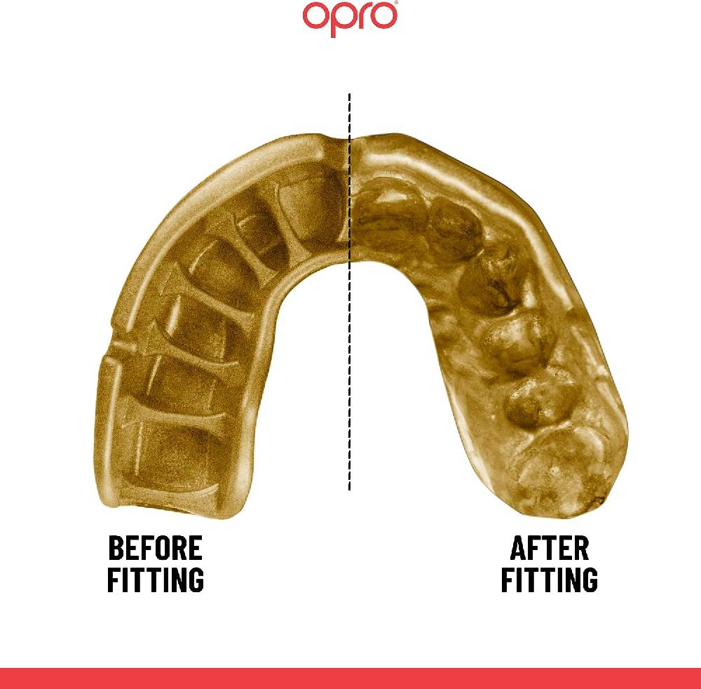 Ju Sports OPRO Zahnschutz Gold Grillz black/gold Senior 2022 Räumungsverkauf