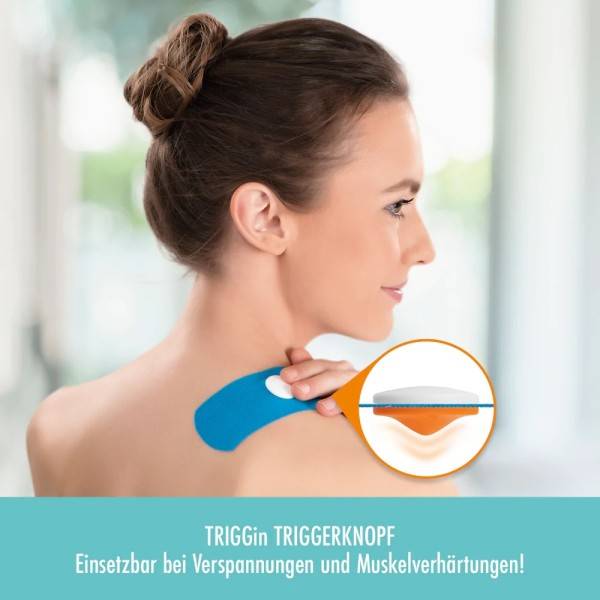 Schupp TRIGGin Triggerknopf (MD) Günstig kaufen