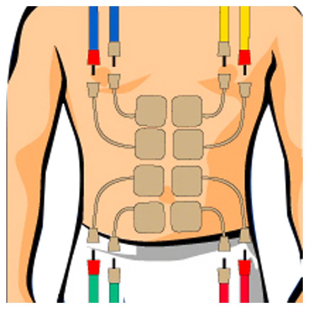 Sport Tec Compex Elektroden Wire, 5x5 cm, 4 Stück 50% Rabatt mit kostenlosem Versand