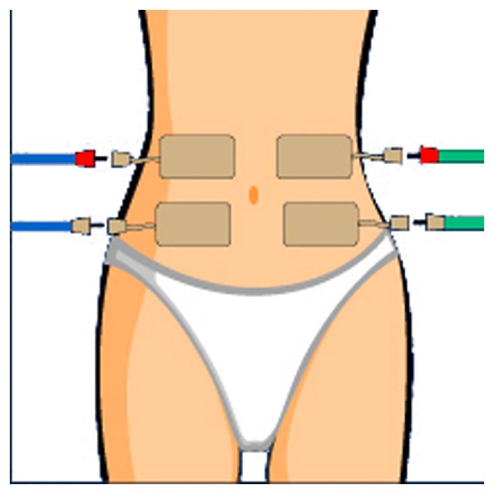Sport Tec Compex Elektroden Wire, 5x10 cm, 2 Stück Clearance-Verkauf