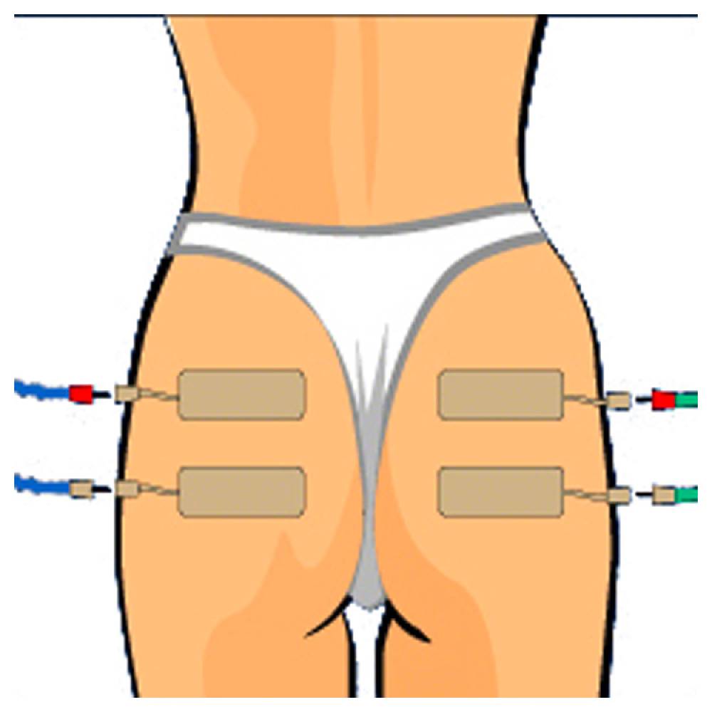 Sport Tec Compex Elektroden Wire, 5x10 cm, 2 Stück Clearance-Verkauf