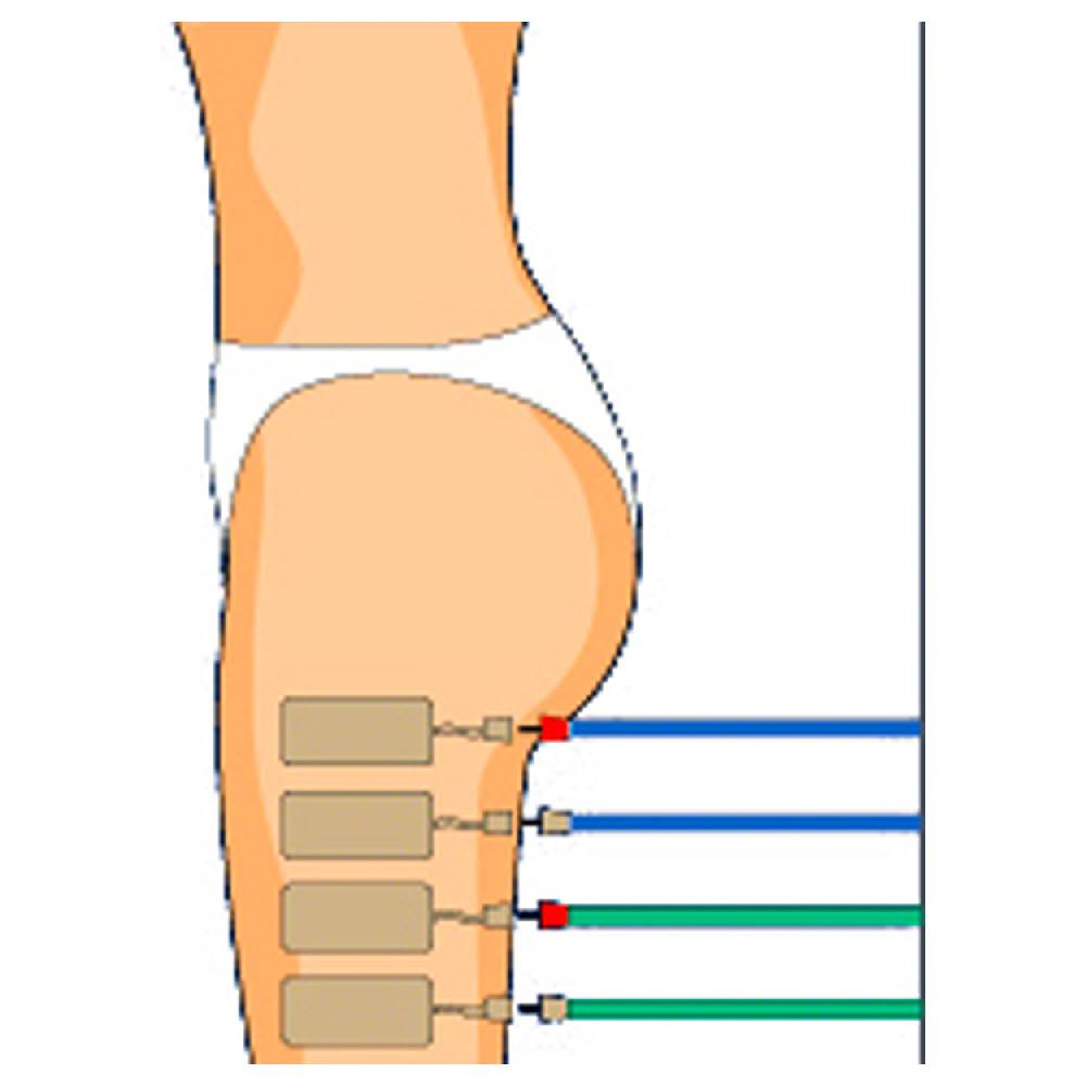 Sport Tec Compex Elektroden Wire, 5x10 cm, 2 Stück Clearance-Verkauf